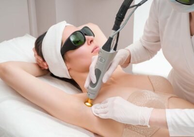 Laser Hair Removal